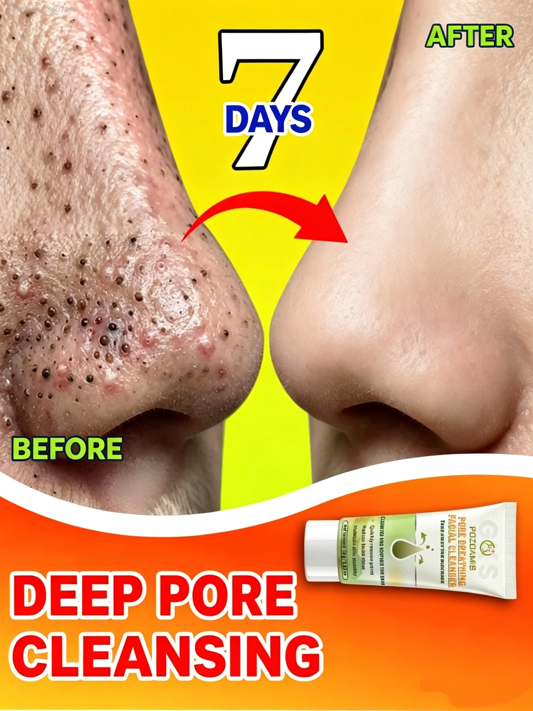 Blackhead-Clearing Cleanser For Deeply Purified Pores In Just 7 Days.