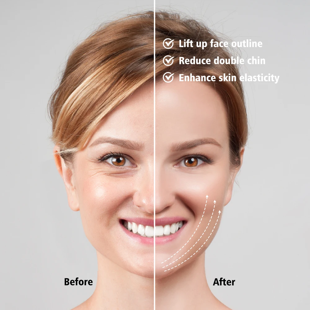 Electic led fóton rosto magro v-linha levantar cinto máquina terapia dispositivo de levantamento facial infravermelho rosto emagrecimento vibração massagem