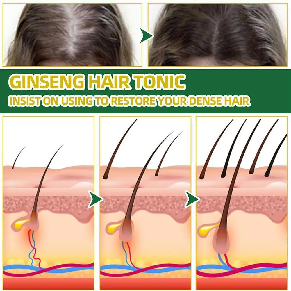 Ouhoe-ginseng soro óleo com biotina líquido essencial para o cabelo, reparação radicular, nutritivo