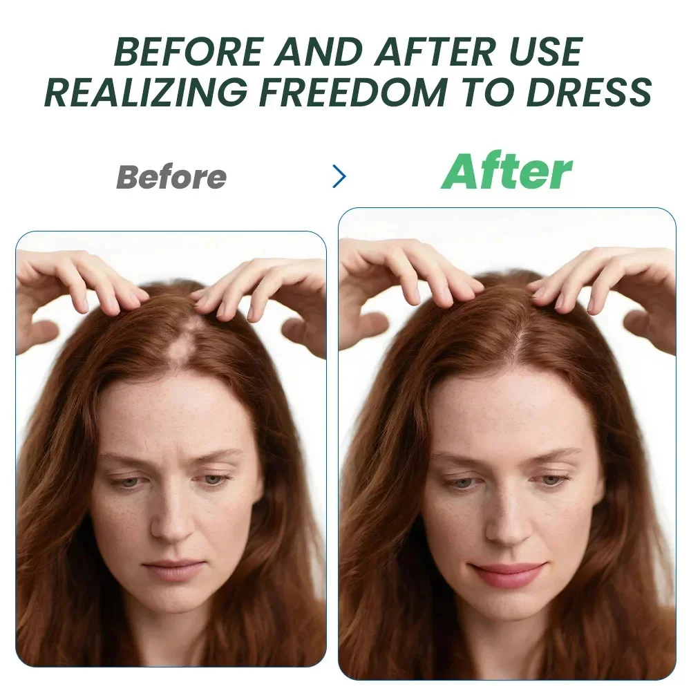 

Hair Growth Cream 7 Days Fast Regrowth Essential Capsule Anti Hair loss Baldness Repair Damaged Scalp Treatment For Women Men