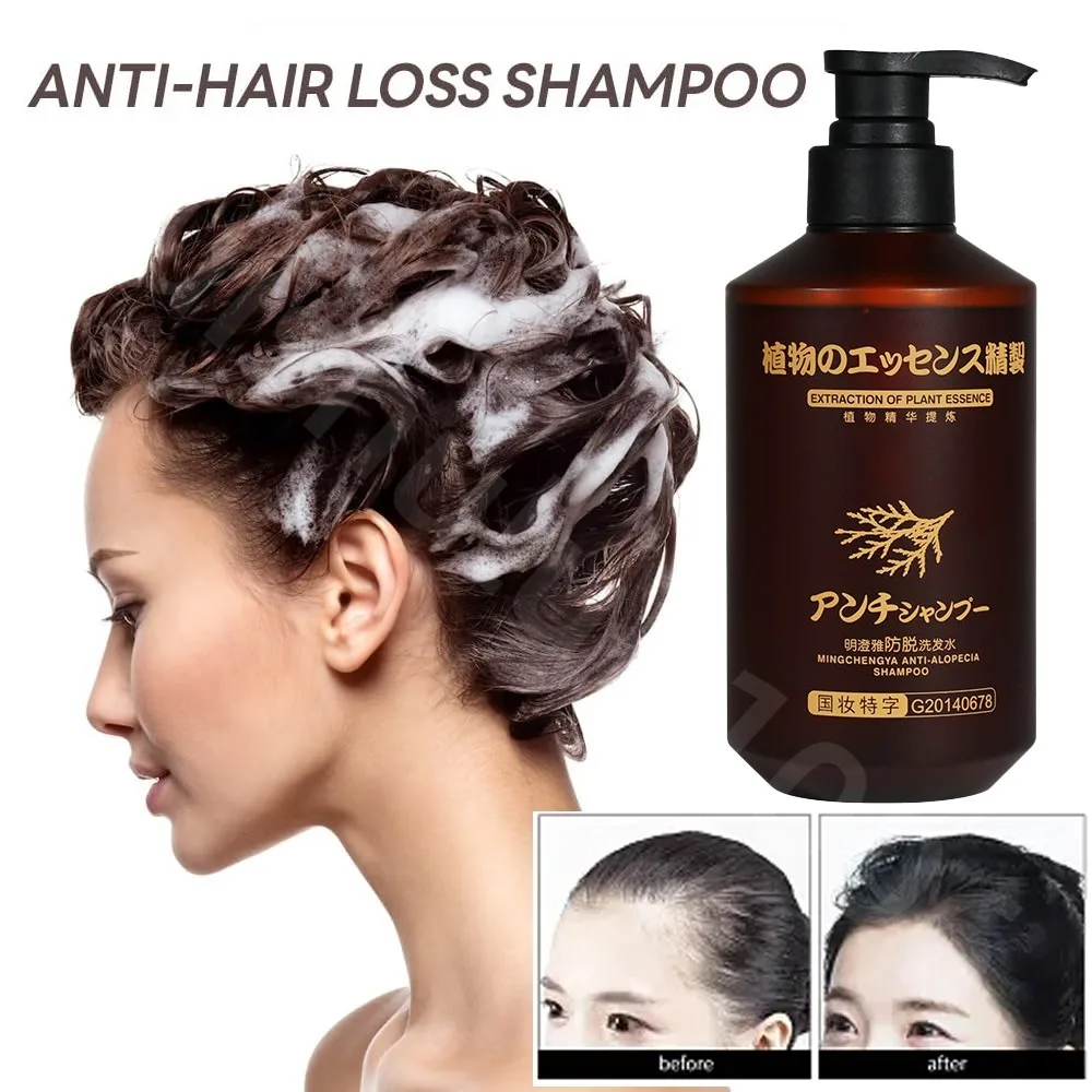 Oriental Arborvitae Moisturizing Nourishing Anti-hair Loss Shampoo Hair Growth Repair Scalp Frizzy Damaged