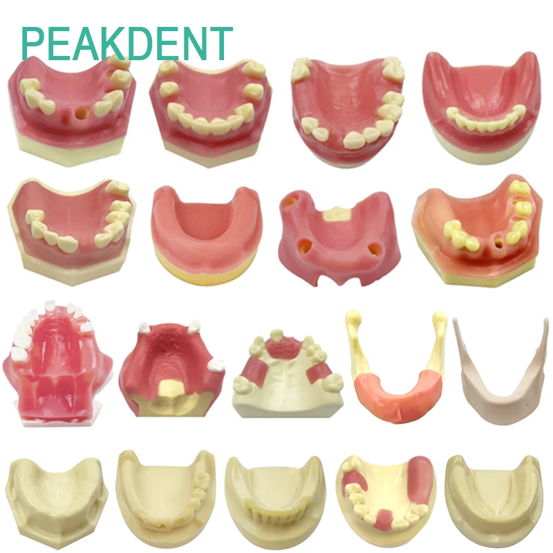 

Модель зубного имплантата, верхняя/межневидная пазуха, мягкий имплантат, модель отсутствия зуба, экспериментальная обучающая практика для студентов-стоматолога