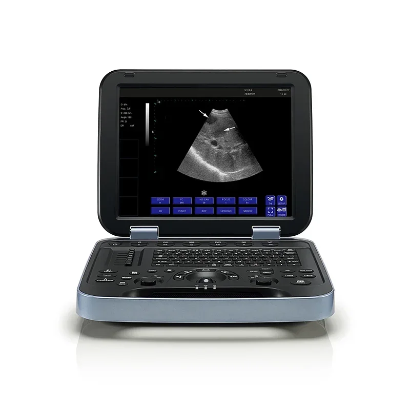 Periodmed 3D Double Probe Portable Ultrasound Black And White Ultrasound Machine China Portable Ultrasound Machine