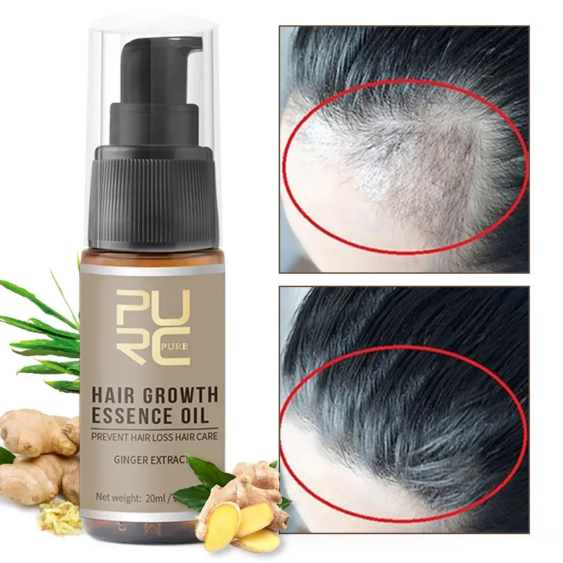 

30ml Hair Growth Spray Natural Ginger Essence Spray Effective Extract Anti Hair Loss Nourish Root Hair Care Treatment Gorras