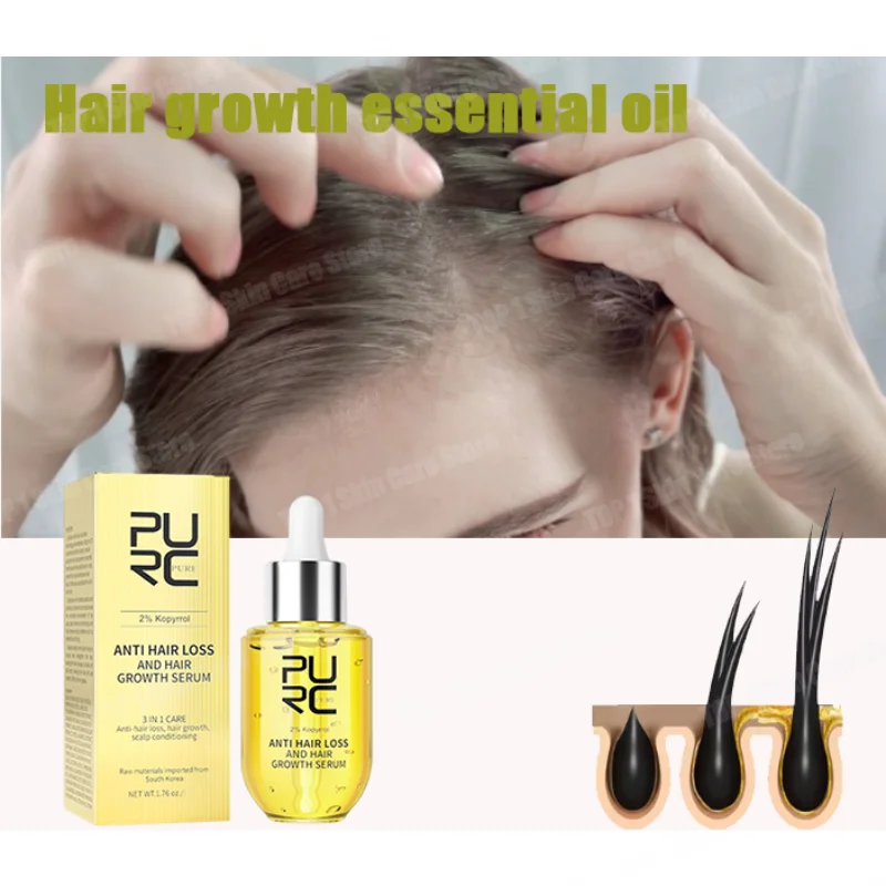 

Magic hair growth liquid, a touch of fresh, say goodbye to hair loss embarrassment