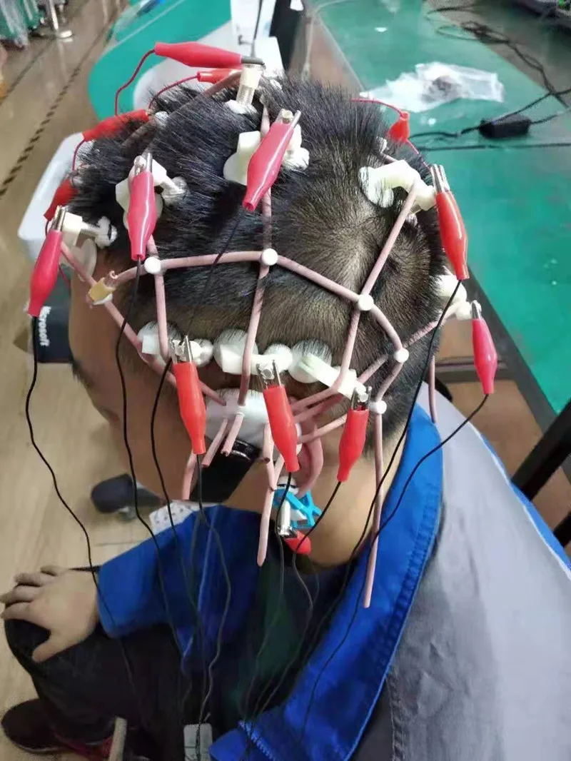 Detector do EEG de Digitas com mapa topográfico do EEG, análise de dados do EEG