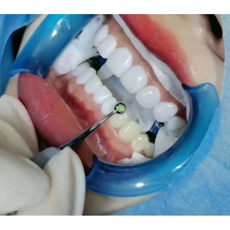 Thumbnail 2 - #48 Compare Teeth Whiteners Before You Buy