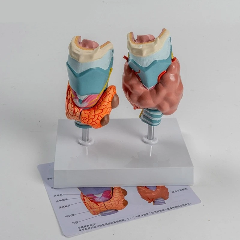 Учебное пособие для модели патологической анатомии щитовидной железы человека, анатомическая патологическая модель горла железы