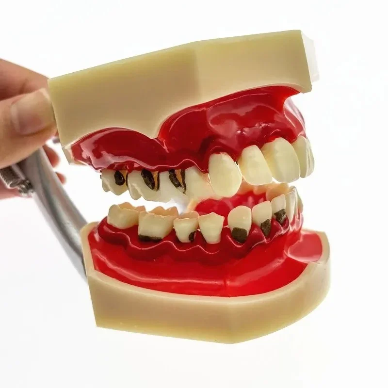 Teeth Model Study Adult Pathological Periodontal disease for Oral Simulation practice teeth Model