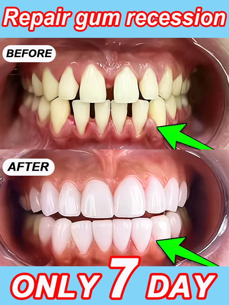เอสเซนส์ป้องกันฟันผุ ฟื้นฟูเคลือบฟัน ซ่อมแซมฟัน เสริมสร้างความแข็งแรง ซ่อมแซมฟันผุ