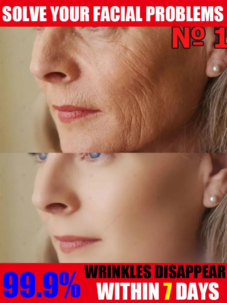 

Не ваши линии, от морщин