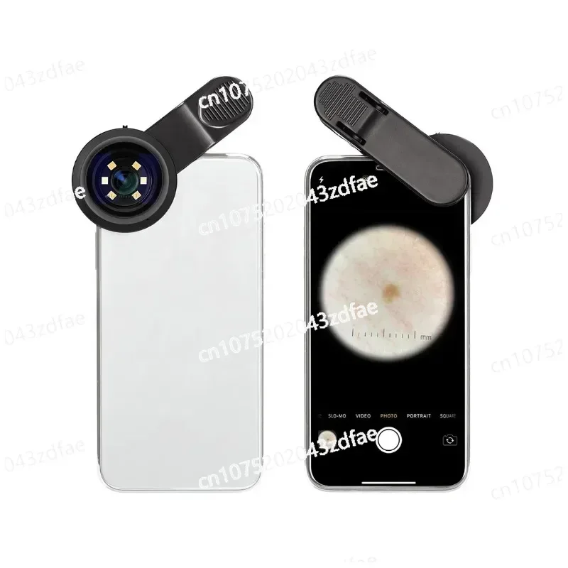 Portable Dermatoscope Magnifying Glass DE-300 Polarized and Non-Polarized Optical Dermatoscope