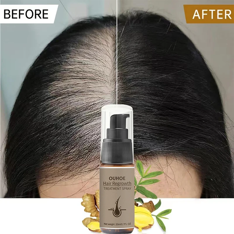 Crescita dei capelli zenzero siero Spray potente Anti perdita di capelli prodotti per il trattamento riparazione nutrire le radici dei capelli ricrescita rapida capelli donna uomo