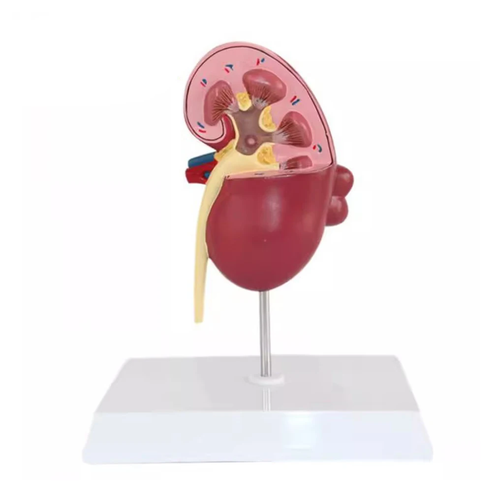 1 Pcs Life Size Kidney Pathologies Model Human Body Anatomy Replica of Diseased Kidney Medical Office Supplies Educational Tool