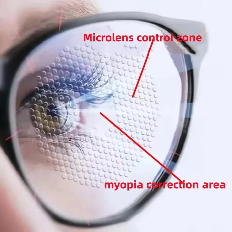 Multi-point Defocus Myopia Control Lenses Children Teenager Eyes Relief Protection Anti-blue Light Optic Prescription Micro Lens