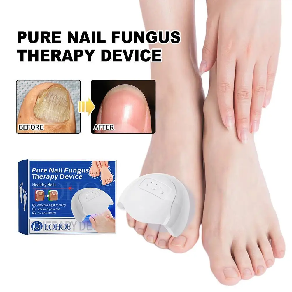 Fungal Nail Laser Device Fast Nails Fungus Repair Onychomycosis Repair Toenail Fingernail Removes Nail Fungus Foot Care Device