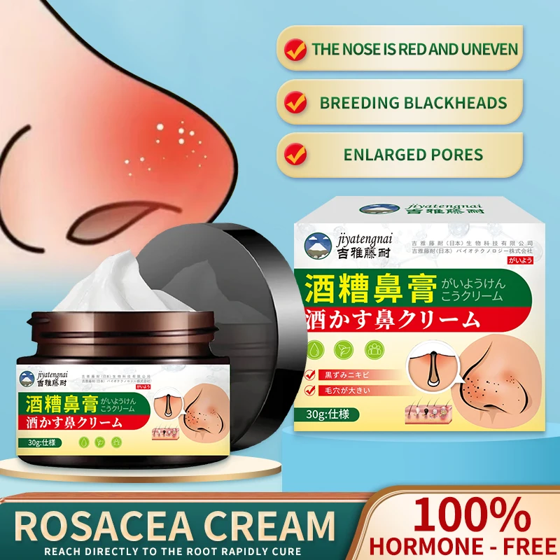 Rosacea-zalf - een actuele gezondheid - Verzorgingspasta voor neusroodheid, vergrote poriën, gebroken capillaires, mee-eters en gerelateerde drosacea-zalf - Een actuele gezondheid - verzorgingspasta voor neusroodheid, vergrote poriën, gebroken