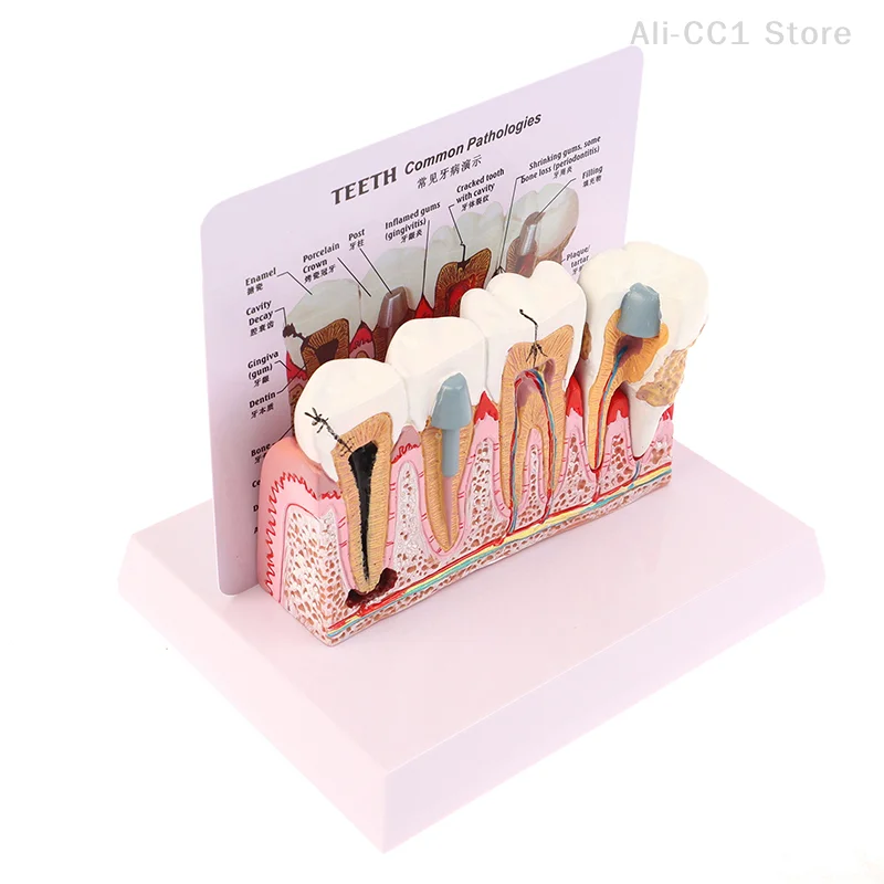 Standard Dental Oral Teeth Anatomical Teaching Model Comprehensive Tooth Structure Model Dentist Dental Student Demonstration
