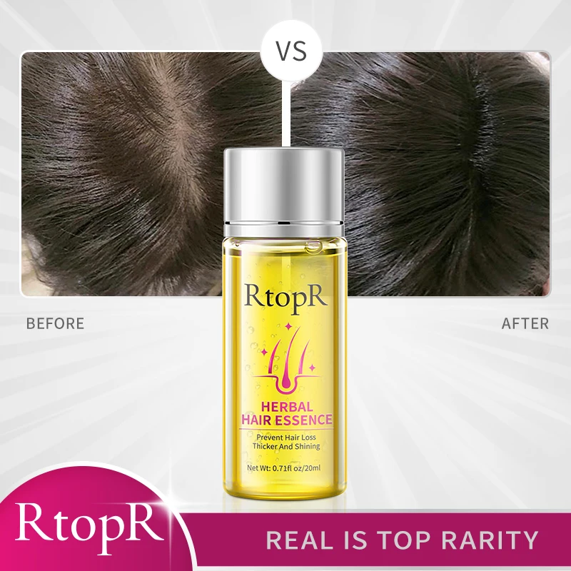 RtopR Herbal Rebirth Growth Hair Thick Essence Prevent Hair Loss Promote Shining  Scalp Repair Regrowth Nourish  Essential Oil