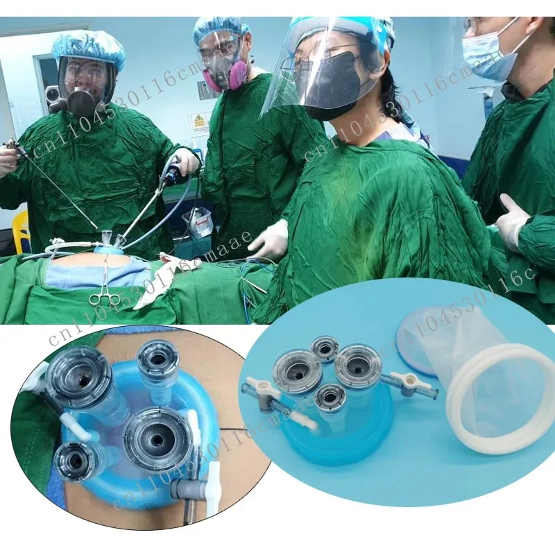 2026Disposable Endoscopic Specimen Sterile Laparoscopic Endoscope Bag Disposable Tissue Collection Bag