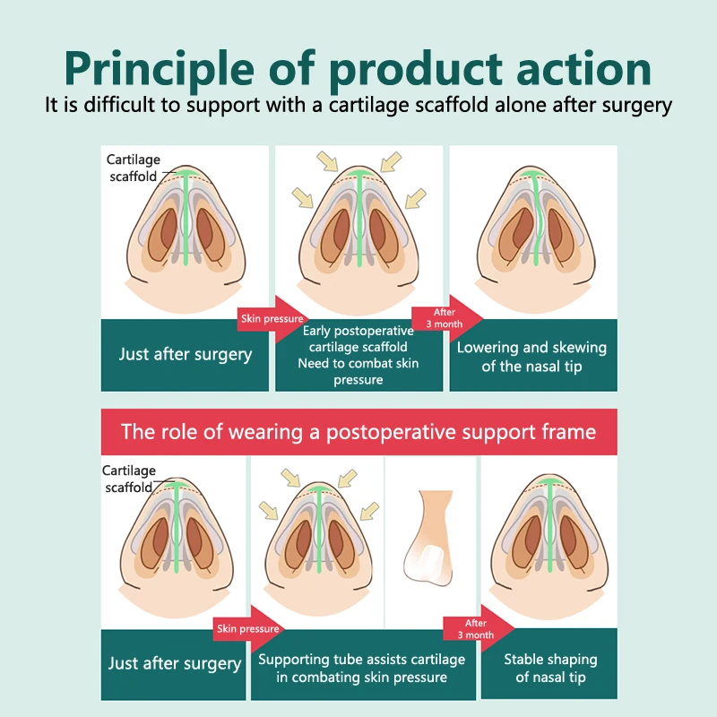 Nostril Support Device Postoperative Rhinoplasty Nostril Support Shaping Crooked Nose Correction Fixator Silica Gel Nose Clip