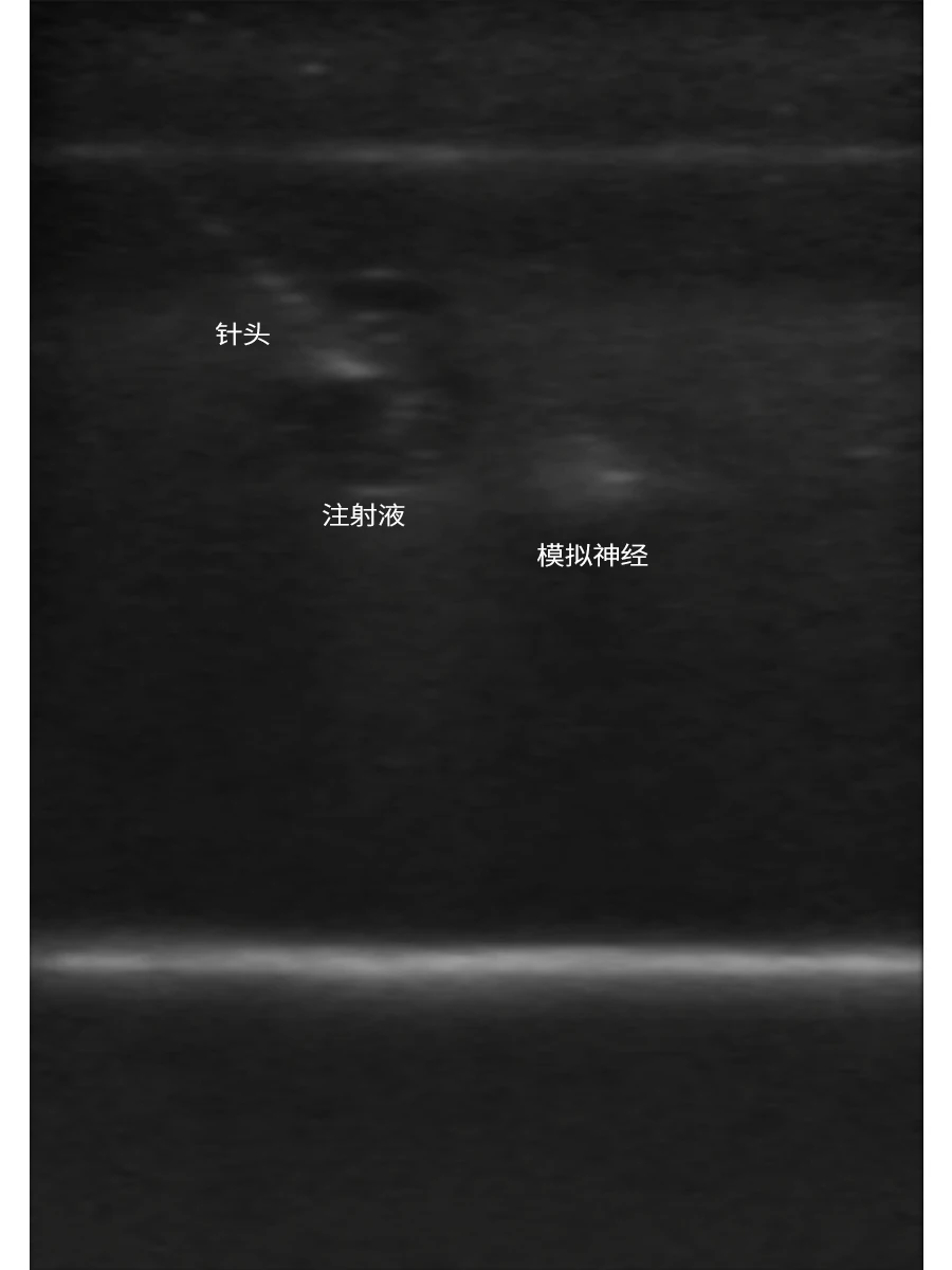 Ultrasound Nerve Block Training Model for Anesthesia Injection Practice Phantom