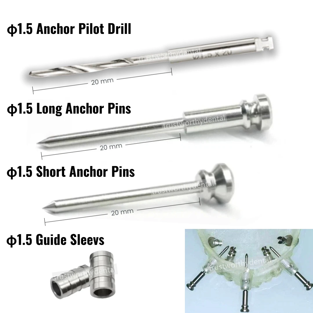 

φ1.5 Dental Anchor Pin Guided Template Fixation Pin Guided Twist Drill Anchor Drills Digital Implant Guide Surgery Fits 3DDX