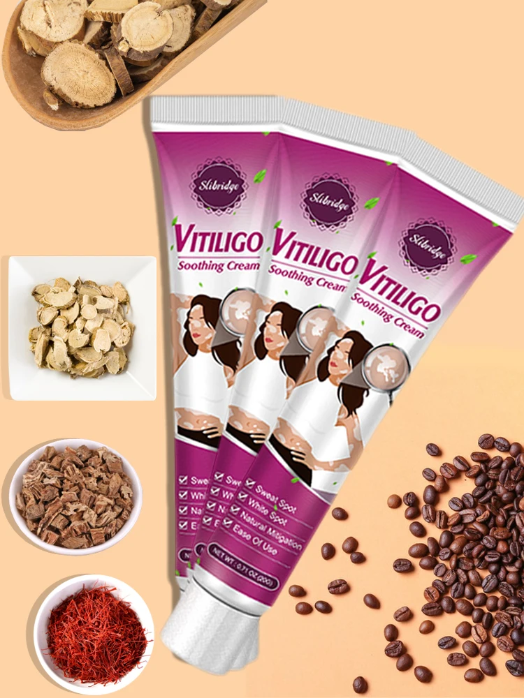 Crema para manchas blancas de Vitiligo, crema para manchas blancas, Leukoplakia, pigmentación, melanina, promueve el Vitiligo, cuidado de la piel