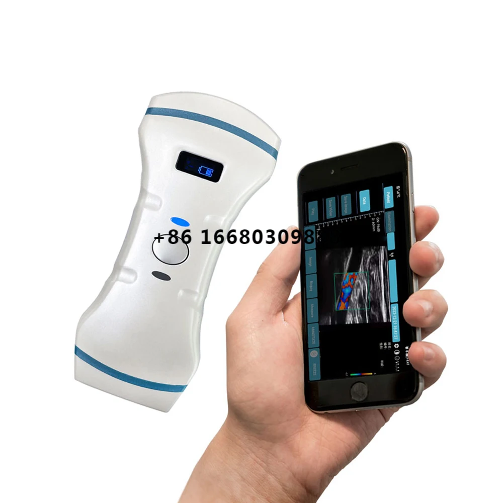 

High Quality Portable Wireless 2-in-1 Convex and Linear Probe Color Doppler Ultrasound Medical Instrument