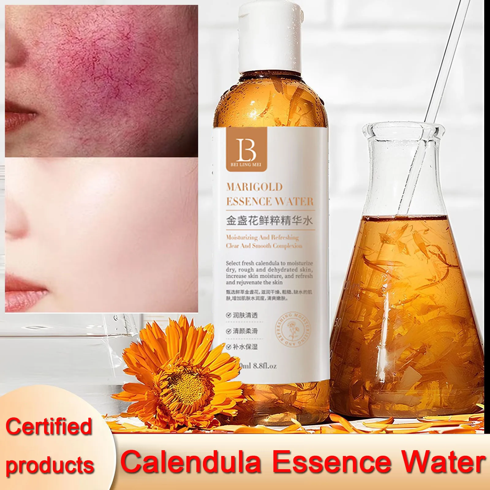 Calendula Toner Moisturizing Repair Oil Control Soothing Serum Acne Remover Lifting Firming Wrinkles Glowing Facial Care 250ml