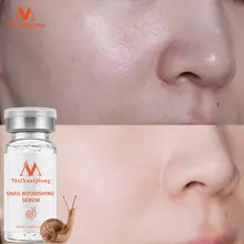 Snail Pore Shrinking Essence #4