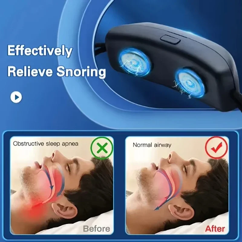 Thumbnail 4 - #8 Highest Rated Snoring & Sleep Apnea Aids to Buy in 2026