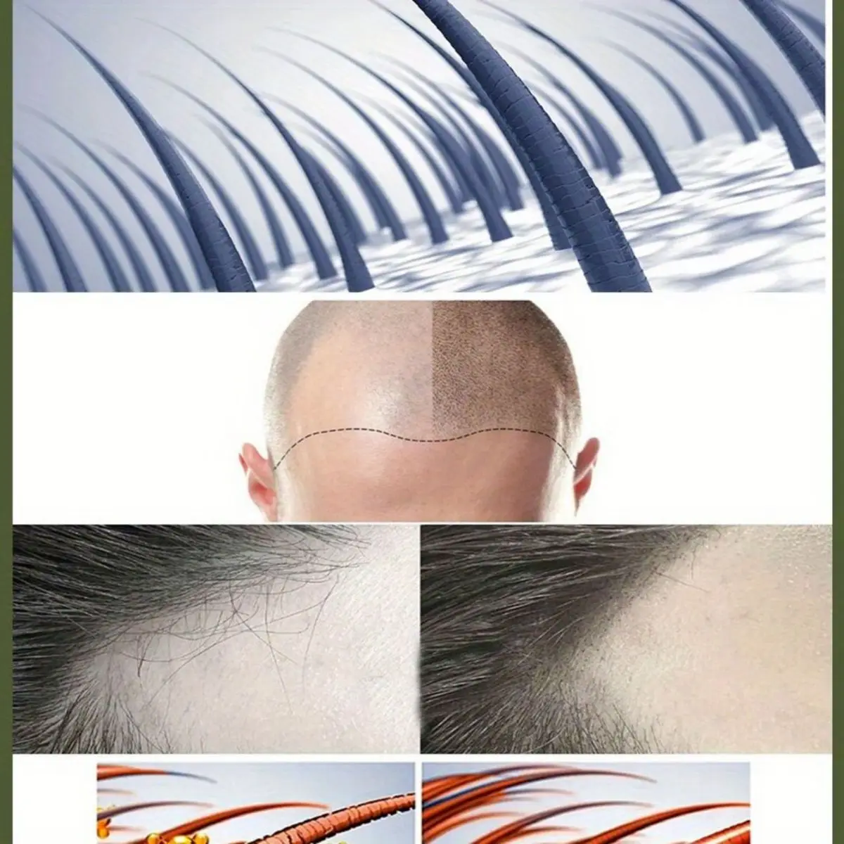 Crescimento do cabelo para homens ferramenta de crescimento de óleo essencial reparação do cabelo proteção furcation cuidados com o crescimento do