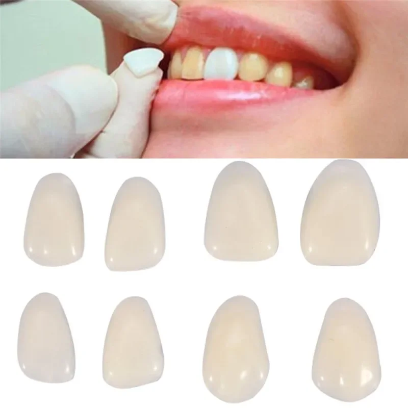 50 pièces/paquet – Films dentaires temporaires en résine ultra-fins pour blanchiment des dents supérieures antérieures, dents en porcelaine, facettes dentaires