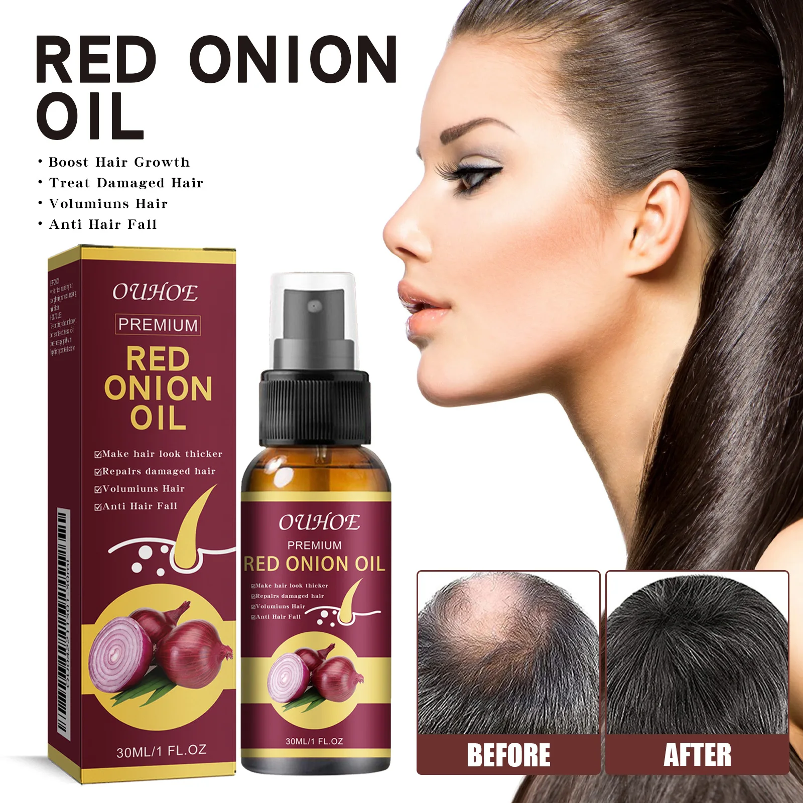 Onion Dense Hair Essential Oil Hair Dense Soft Strong Hair Care Oil Anti dropping Firm Moisturizing Hair Conditioner spray