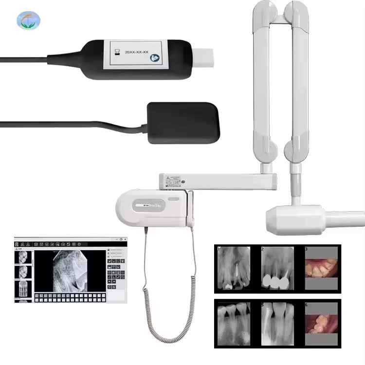 Hospital New Style Flexible Arm Mobile Dent l X Ray  Denal Cliic Teeth Imaging Wall  Mounted Digital Denta X-Ray