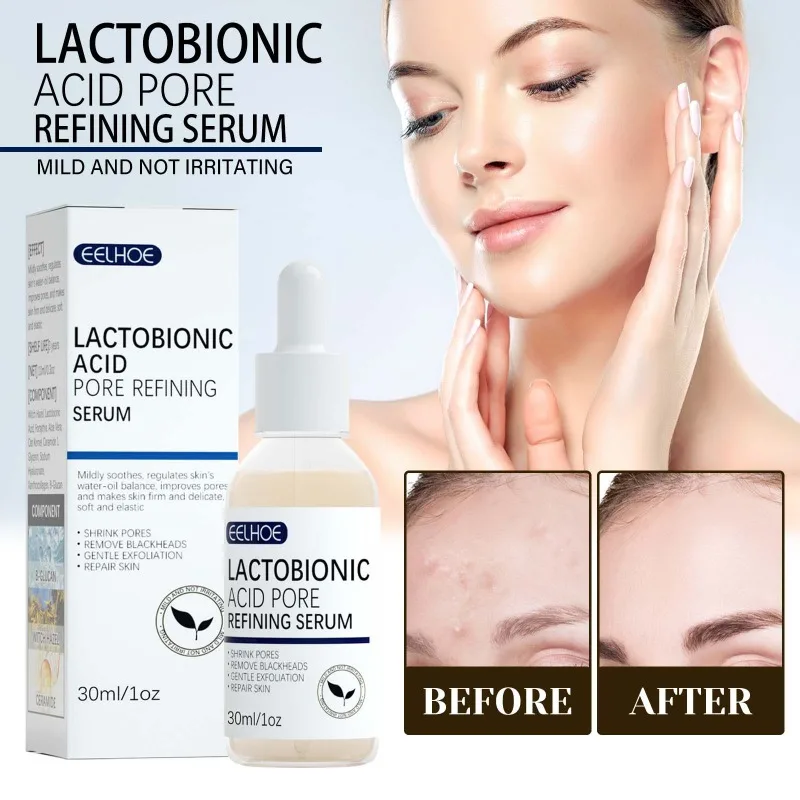 

Lactic Acid Serum For Pore Shrinking Improves Skin Elasticity And Delicacy Repairs Cleans Blackheads Acne Skincare