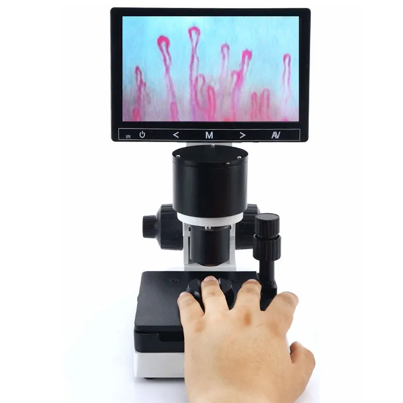 Profesional Nailfold Capillary Microcirculation USB HD digital Microscope Blood Microcirculation LCD Displayer