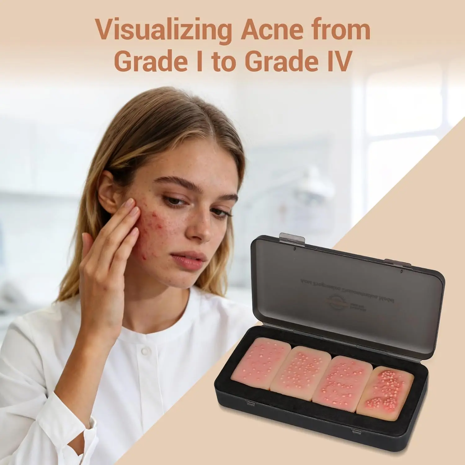Complete Acne Progression Demonstration Model Visual Teaching Skin-Like Silicone for Dermatology Nursing & Medical Education