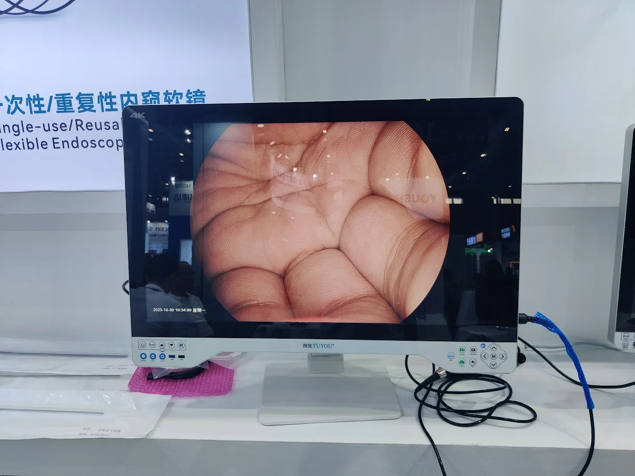 Tuyou 32''  Portable Rigid Medical Video Endoscopy Camera System Come with LED Light Source for Laparoscopy Urology