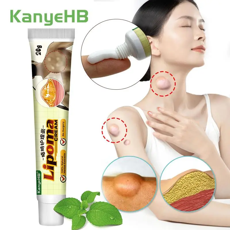 

1Pcs Lipoma Treatment Cream Lipolysis Removal Skin Tumor Pain Ointment Relief Skin Swell Exfoliating Cellulite Herbal Cream G040