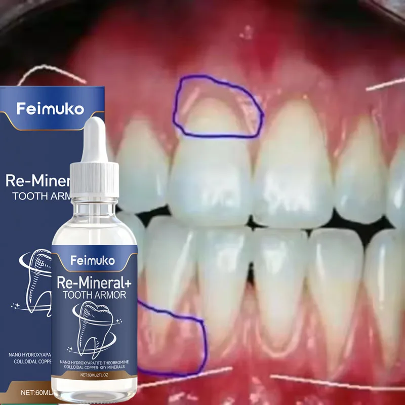 Rapid Repair Gums Serum Effectively Relieve Tooth Allergy Dental Caries Cleaning Toothpaste Relieve Tooth Damage Drops