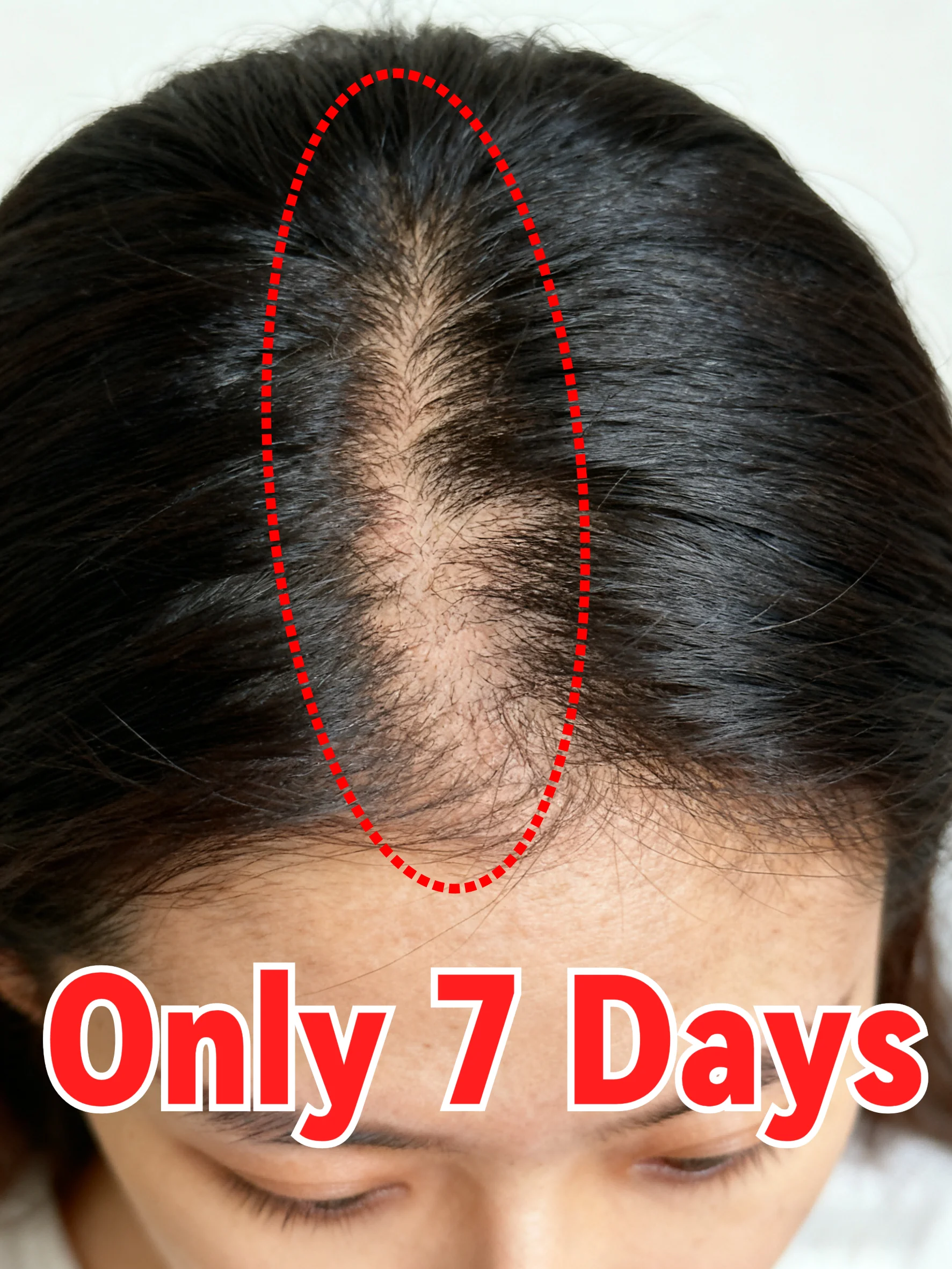 

Hair Growth Serum Oil Apply Combination，Scalp Applicator Liquid Comb for Hair Scalp Treatment, device for Abundant Hair