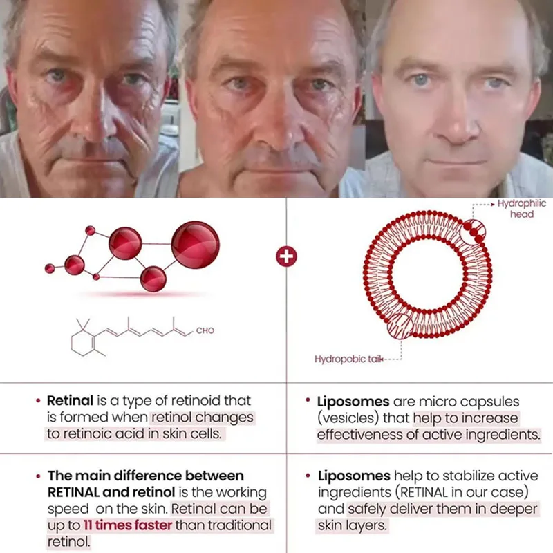 مصل الوجه لإزالة التجاعيد الفورية من الريتينول لشد البشرة والخطوط الدقيقة الكورية المضادة للتجاعيد منتجات العناية بالبشرة ﻿