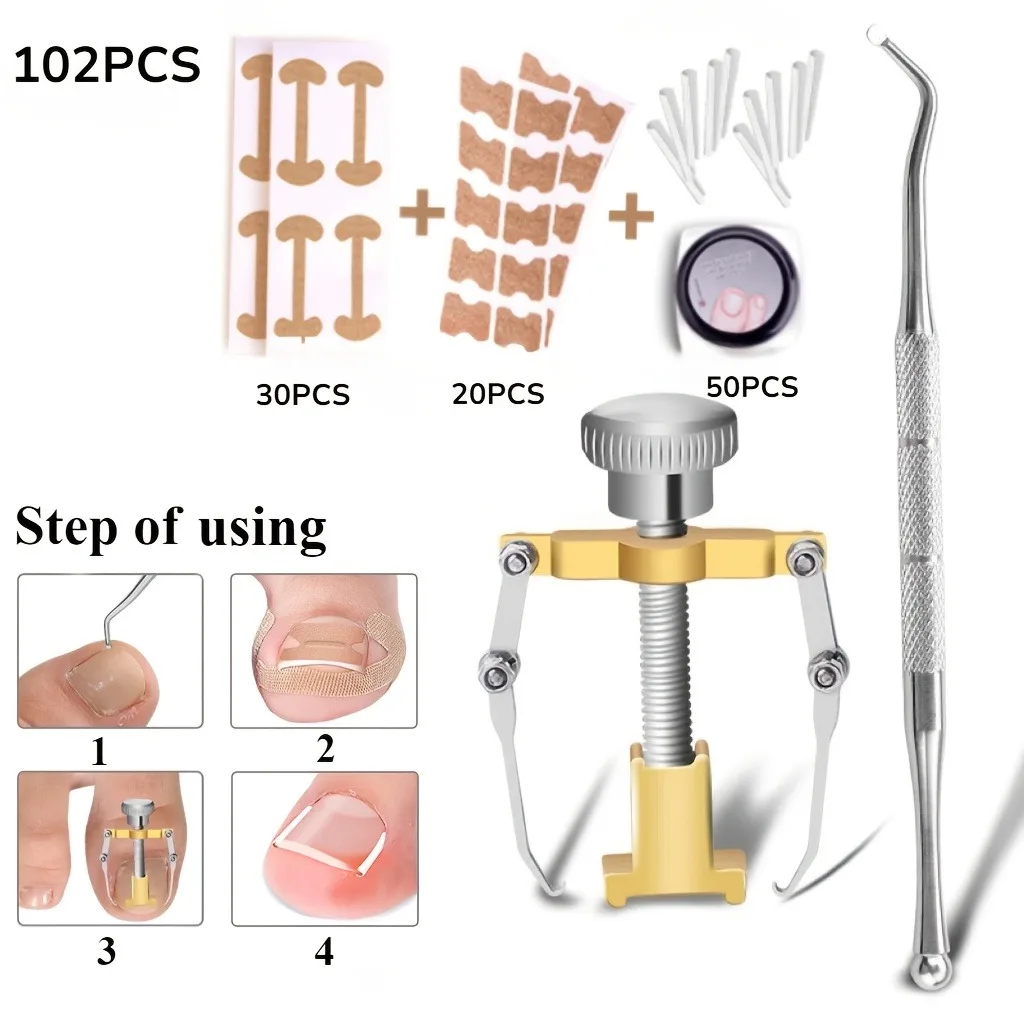 Professional Ingrown Toenail Correction Tool(102/104/107pcs) Curved Pliers Nail Separator Nail Nipper Fixer Pedicure Correctors