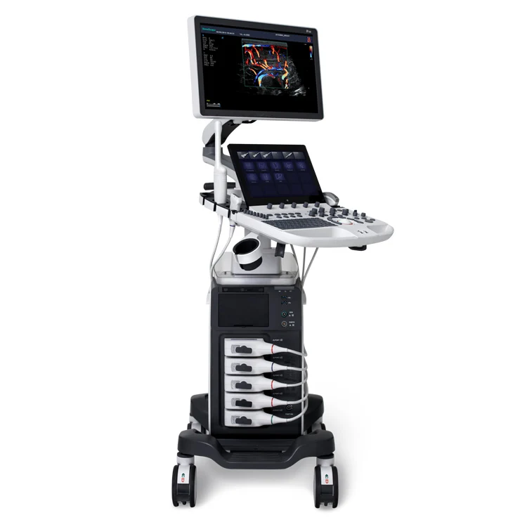 Products subject to negotiationAdvanced Touch Screen Sonoscape P40 Digital Color Doppler Ultrasound Machine