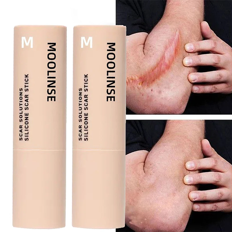 

Scar Stick For Face And Body Skin Repair Treatment Scar Wrinkle Remover Cream