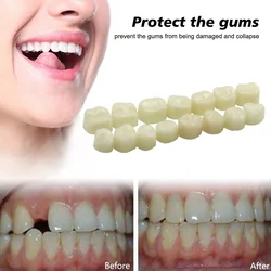 Dental Teeth Veneers Ultra Thin Whitening Resin Anterior Upper Temporary Crown Porcelain Dental Material For Oral Care