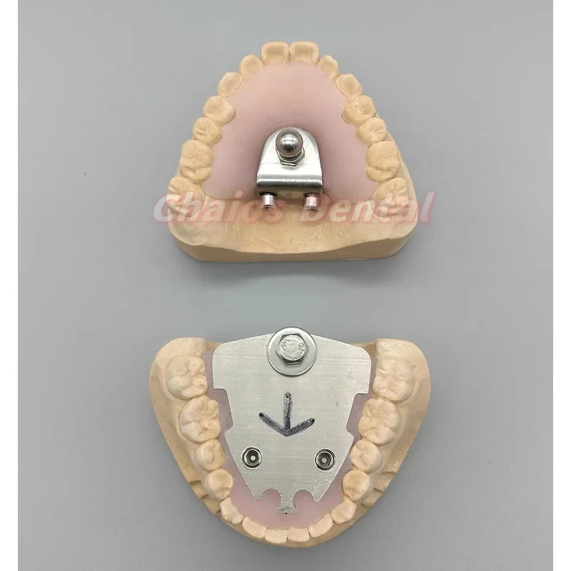 1 ชุดทันตกรรม Gothic Arch Intraoral Registration Jawrecorder Gnathometer Centrofix ชุด Artex Articulator อุปกรณ์เสริม