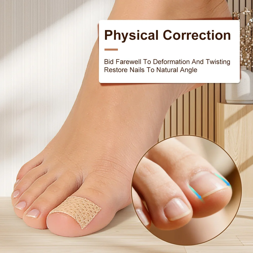 Toenail Fungus Patch Nail Repair Patches Nail Ingrown Correction Stickers for Discolored or Damaged Nails Sticker Toenail Care